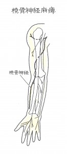 上腕骨骨幹部骨折２