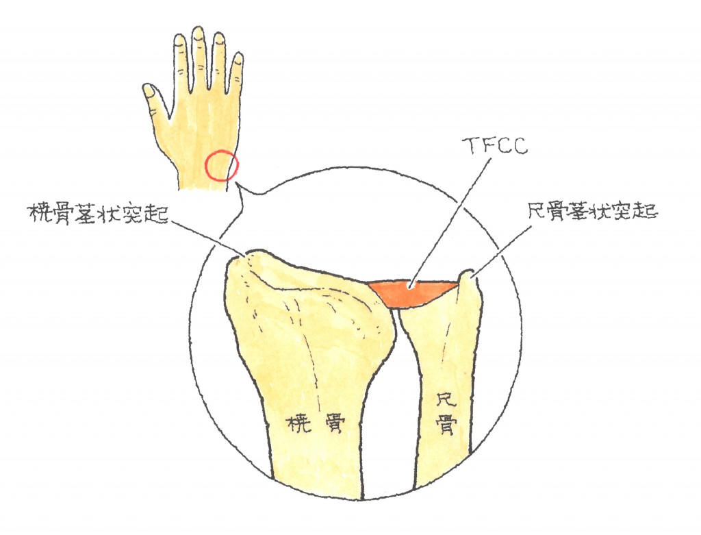 手根骨の骨折　TFCC損傷