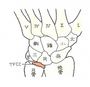 手根骨の骨折　TFCC損傷２